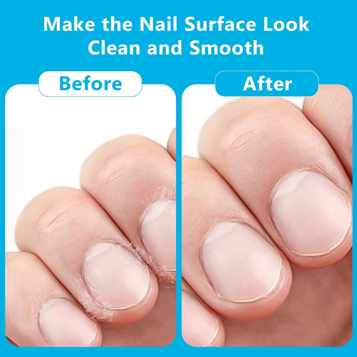 3 Pcs Facial Cleansing Brush, Useekoo Manual Face Brushes for Cleansing and Exfoliating, Face Scrubber to Massage, Deep Pore Exfoliation, Makeup Remove and Skin Care with Soft Bristles