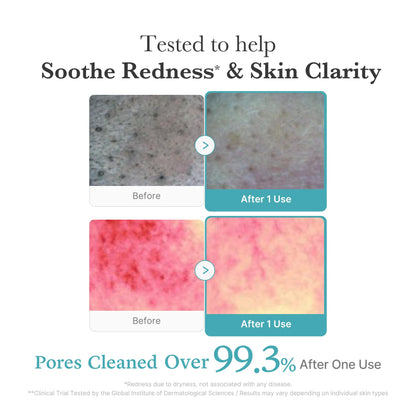 medicube PDRN Marshmallow Whip Cleanser | Face Wash, Cleansing Foam for Pore Care & Uneven Skin Tone | Gentle Daily Deep Cleansing | Hydrating and Nourishing Facial Cleanser | Korean Skincare