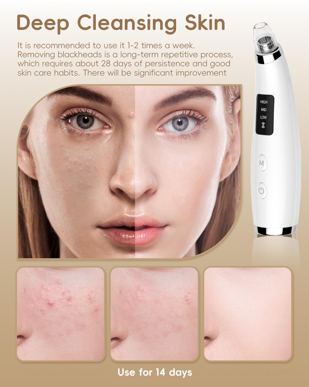Facial Pore Blackhead Remover Vacuum - Fore Cleaner and Blackhead Extractor with 3 Adjustable Suction Levels - 5 Probes - Pore Vacuum Kit for Women&Men (White)