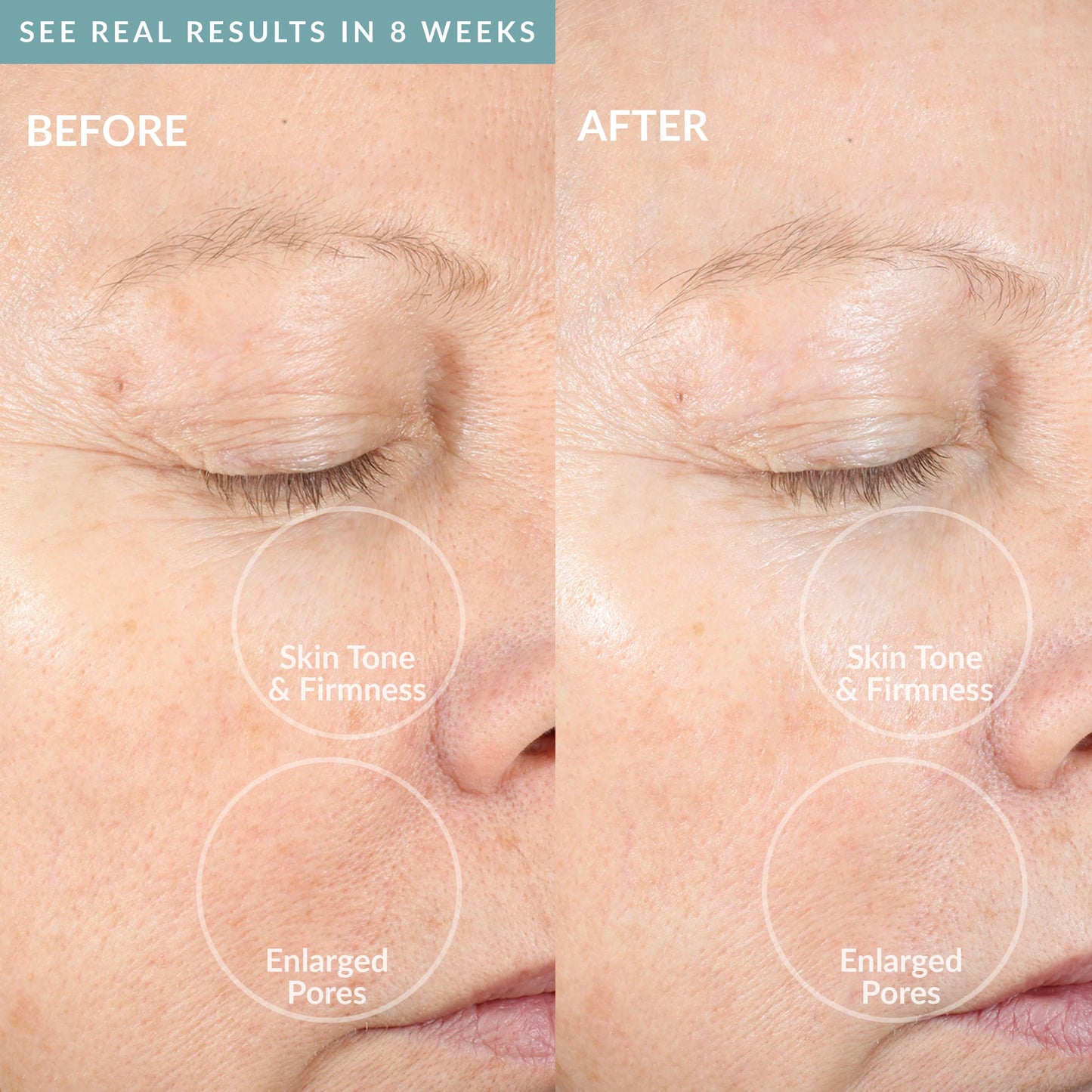 PMD Beauty Clean Pro OB - Smart Facial Cleansing Device