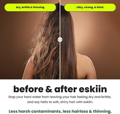 Eskiin Filtered Showerhead - Best Shower Head With Filters For Healthy Hair & Skin - High Pressure Water Softener For Hard Water - Reduce Dandruff, Protect Colored Hair, And Soothe Dry Skin (Chrome)